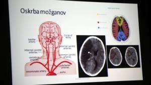 Predavanje o možganski kapi za občane v Braslovčah